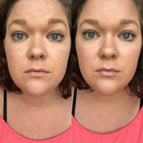 Lip plumper before and after. Things To Know About Lip plumper before and after. 